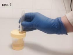Urine analysis for porphyrins